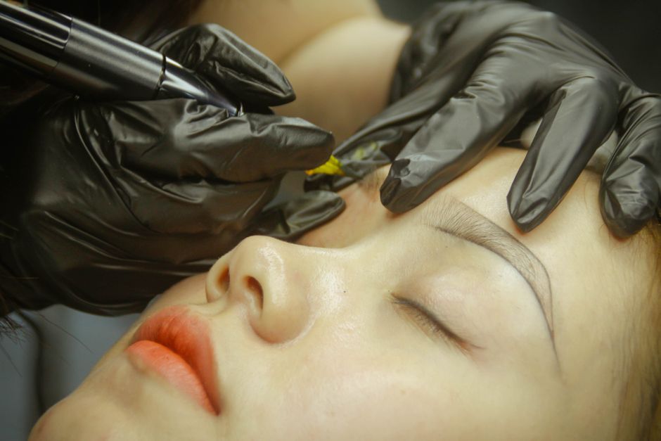 Todo lo que necesitas saber sobre la eliminación de tatuajes con láser